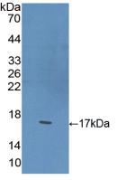 Polyclonal Antibody to Brain Derived Neurotrophic Factor (BDNF)