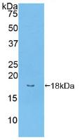 Polyclonal Antibody to Bone Morphogenetic Protein Receptor 2 (BMPR2)