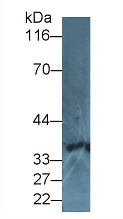 Polyclonal Antibody to Interleukin 8 Receptor Alpha (IL8Ra)