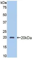 Polyclonal Antibody to Endothelial protein C receptor (EPCR)