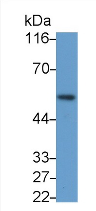 Polyclonal Antibody to Erythropoietin Receptor (EPOR)