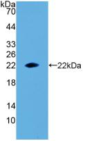 Polyclonal Antibody to Erythropoietin (EPO)