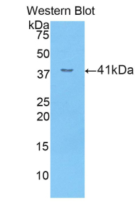 Polyclonal Antibody to E-selectin