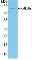 Polyclonal Antibody to Factor Related Apoptosis (FAS)