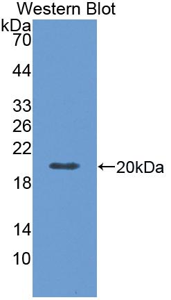 Polyclonal Antibody to Factor Related Apoptosis (FAS)