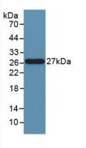 Polyclonal Antibody to Factor Related Apoptosis Ligand (FASL)