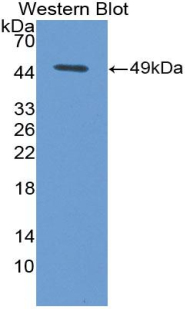 Polyclonal Antibody to Factor Related Apoptosis Ligand (FASL)