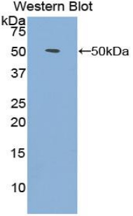 Polyclonal Antibody to Fibroblast Growth Factor 1, Acidic (FGF1)