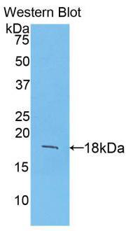 Polyclonal Antibody to Fibroblast Growth Factor 1, Acidic (FGF1)