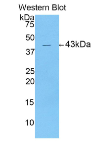 Polyclonal Antibody to Fibroblast Growth Factor 1, Acidic (FGF1)