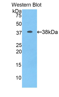 Polyclonal Antibody to Interferon Alpha (IFNa)