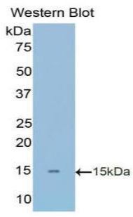 Polyclonal Antibody to Fibronectin (FN)