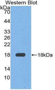 Polyclonal Antibody to Fibronectin (FN)