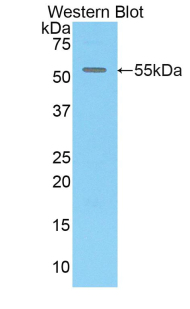 Polyclonal Antibody to Chemokine C-X3-C-Motif Ligand 1 (CX3CL1)