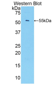 Polyclonal Antibody to Chemokine (C-X-C Motif) Ligand 1 (CXCL1)