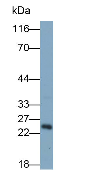 Polyclonal Antibody to Glial Cell Line Derived Neurotrophic Factor (GDNF)