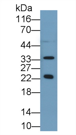 Polyclonal Antibody to Growth Hormone (GH)