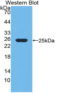 Polyclonal Antibody to Growth Hormone (GH)