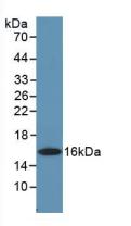 Polyclonal Antibody to Colony Stimulating Factor 2, Granulocyte Macrophage (GM-CSF)