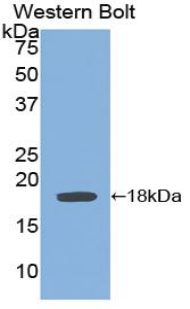 Polyclonal Antibody to Glycoprotein 130 (gp130)