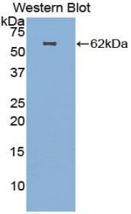 Polyclonal Antibody to Hepatocyte Growth Factor (HGF)