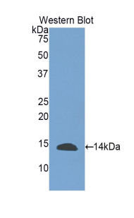 Polyclonal Antibody to Inhibin Beta E (INHbE)