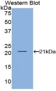 Polyclonal Antibody to Interferon Gamma (IFNg)