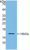 Polyclonal Antibody to Interferon Gamma (IFNg)