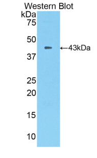 Polyclonal Antibody to Interferon Gamma (IFNg)