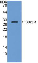 Polyclonal Antibody to Insulin Like Growth Factor Binding Protein 1 (IGFBP1)