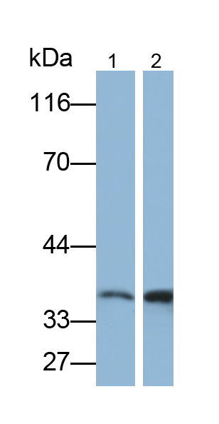 Polyclonal Antibody to Insulin Like Growth Factor Binding Protein 2 (IGFBP2)