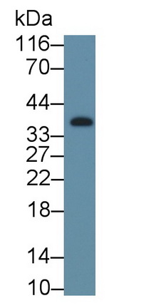 Polyclonal Antibody to Insulin Like Growth Factor Binding Protein 2 (IGFBP2)