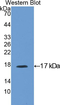 Polyclonal Antibody to Insulin Like Growth Factor Binding Protein 3 (IGFBP3)