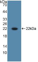 Polyclonal Antibody to Interleukin 10 (IL10)