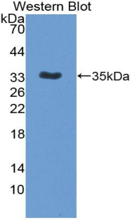 Polyclonal Antibody to Interleukin 12B (IL12B)