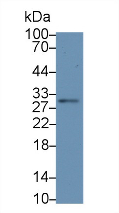 Polyclonal Antibody to Interleukin 12A (IL12A)