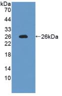 Polyclonal Antibody to Interleukin 12A (IL12A)