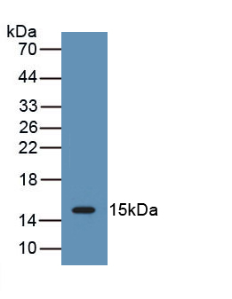 Polyclonal Antibody to Interleukin 15 (IL15)