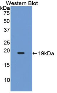 Polyclonal Antibody to Interleukin 17 (IL17)