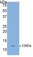 Polyclonal Antibody to Interleukin 1 Receptor Type I (IL1R1)