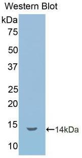 Polyclonal Antibody to Interleukin 1 Receptor Type I (IL1R1)