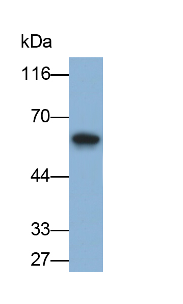 Polyclonal Antibody to Interleukin 1 Receptor Type I (IL1R1)