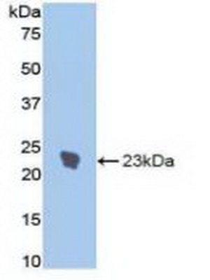 Polyclonal Antibody to Interleukin 1 Receptor Type I (IL1R1)