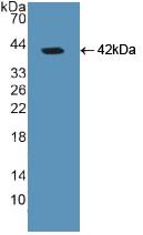 Polyclonal Antibody to Glial Fibrillary Acidic Protein (GFAP)