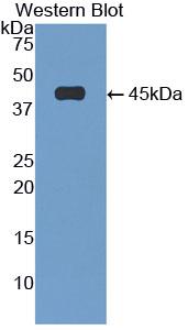 Polyclonal Antibody to Glial Fibrillary Acidic Protein (GFAP)