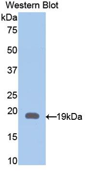 Polyclonal Antibody to Glial Fibrillary Acidic Protein (GFAP)