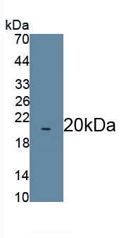 Polyclonal Antibody to Meningioma Expressed Antigen 5 (MGEA5)