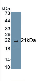 Polyclonal Antibody to Interleukin 2 (IL2)