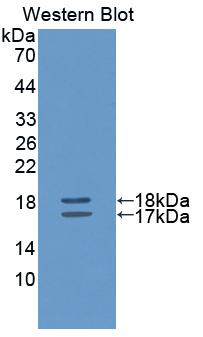 Polyclonal Antibody to Interleukin 2 (IL2)