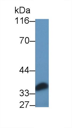 Polyclonal Antibody to Interleukin 6 (IL6)